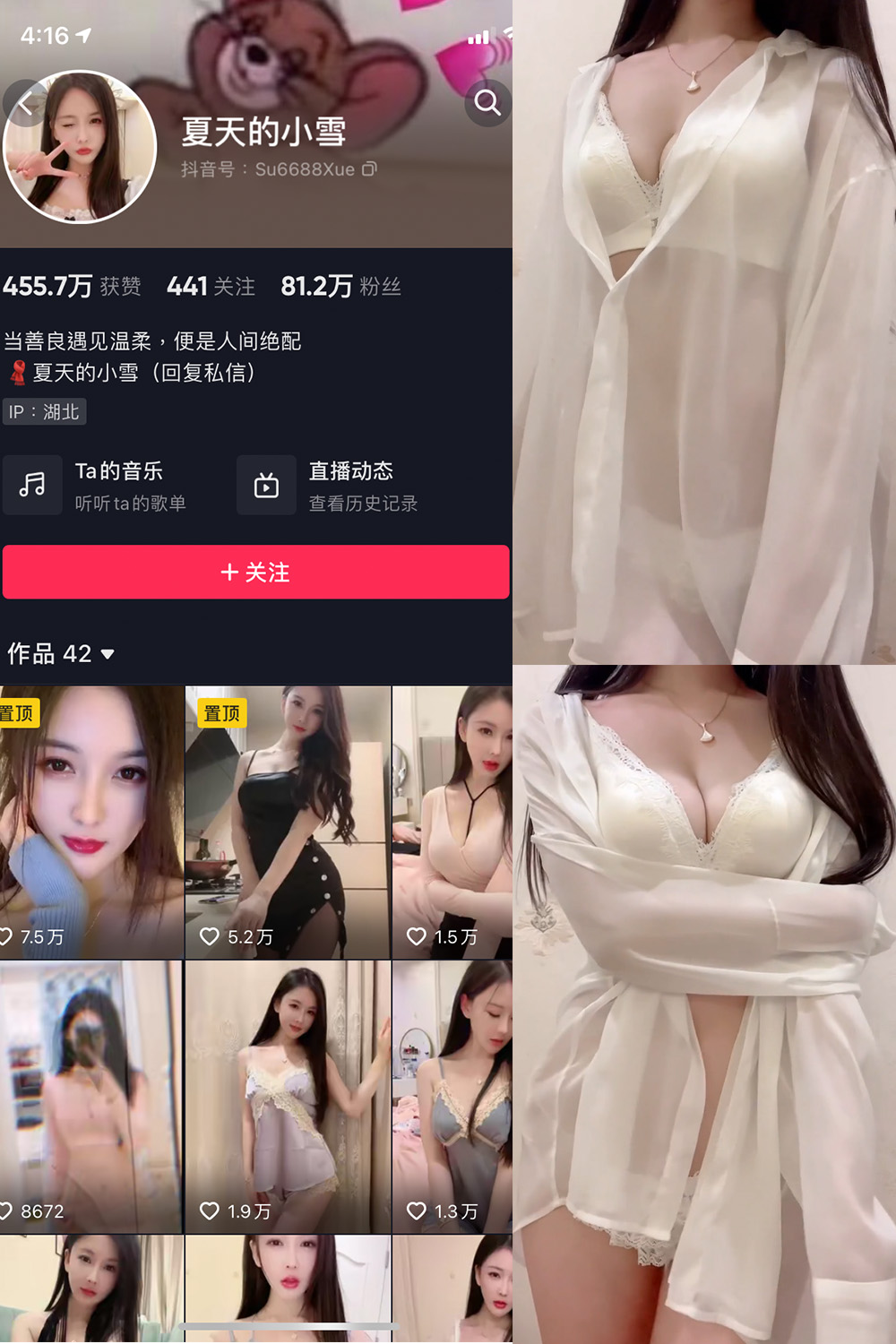 抖音 夏天的小雪 微密圈 嘉宾专享 NO.011期 更新至:2023.8.11