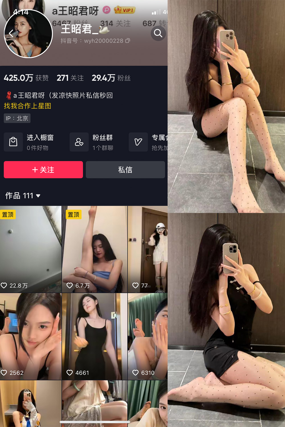 抖音 王昭君 微密圈 NO.022期 更新至:2024.3.13