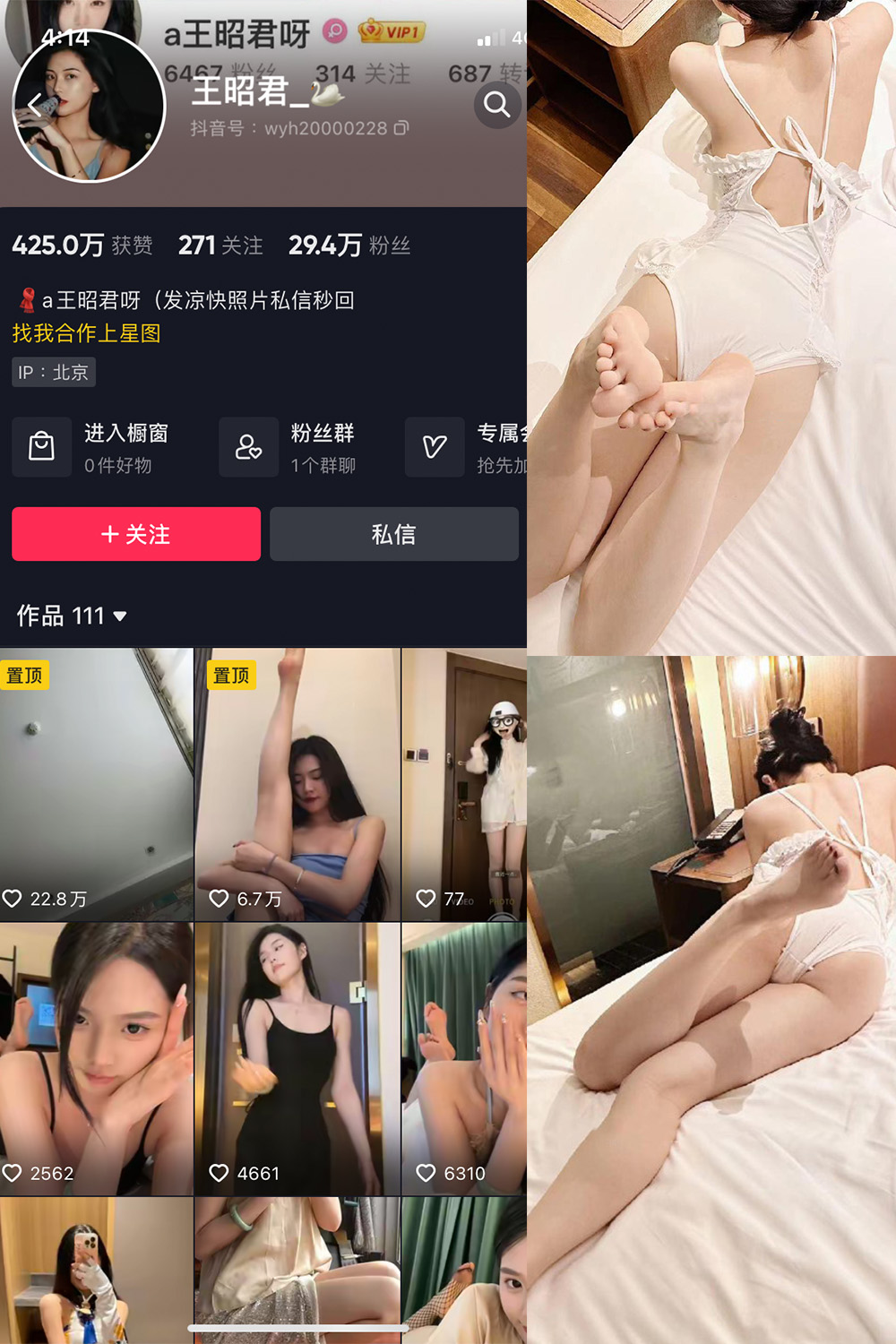 抖音 王昭君 微密圈 NO.023期 更新至:2024.6.6