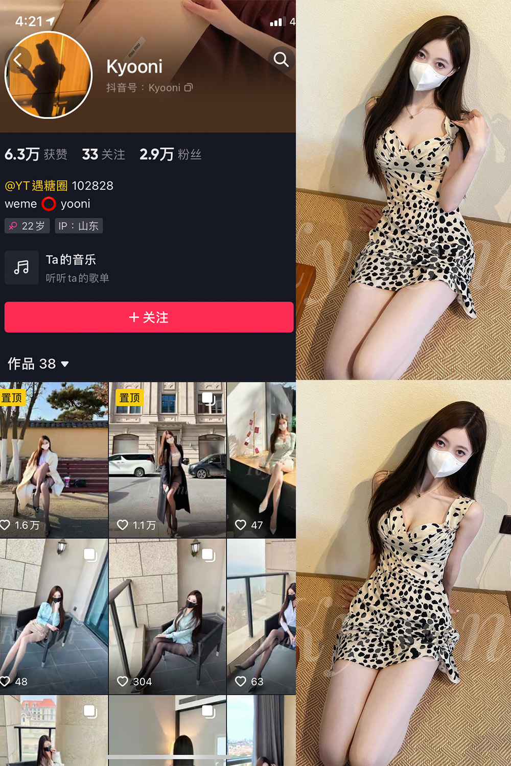 抖音 Yooni有你喵 微密圈 NO.017期 更新至:2023.7.30