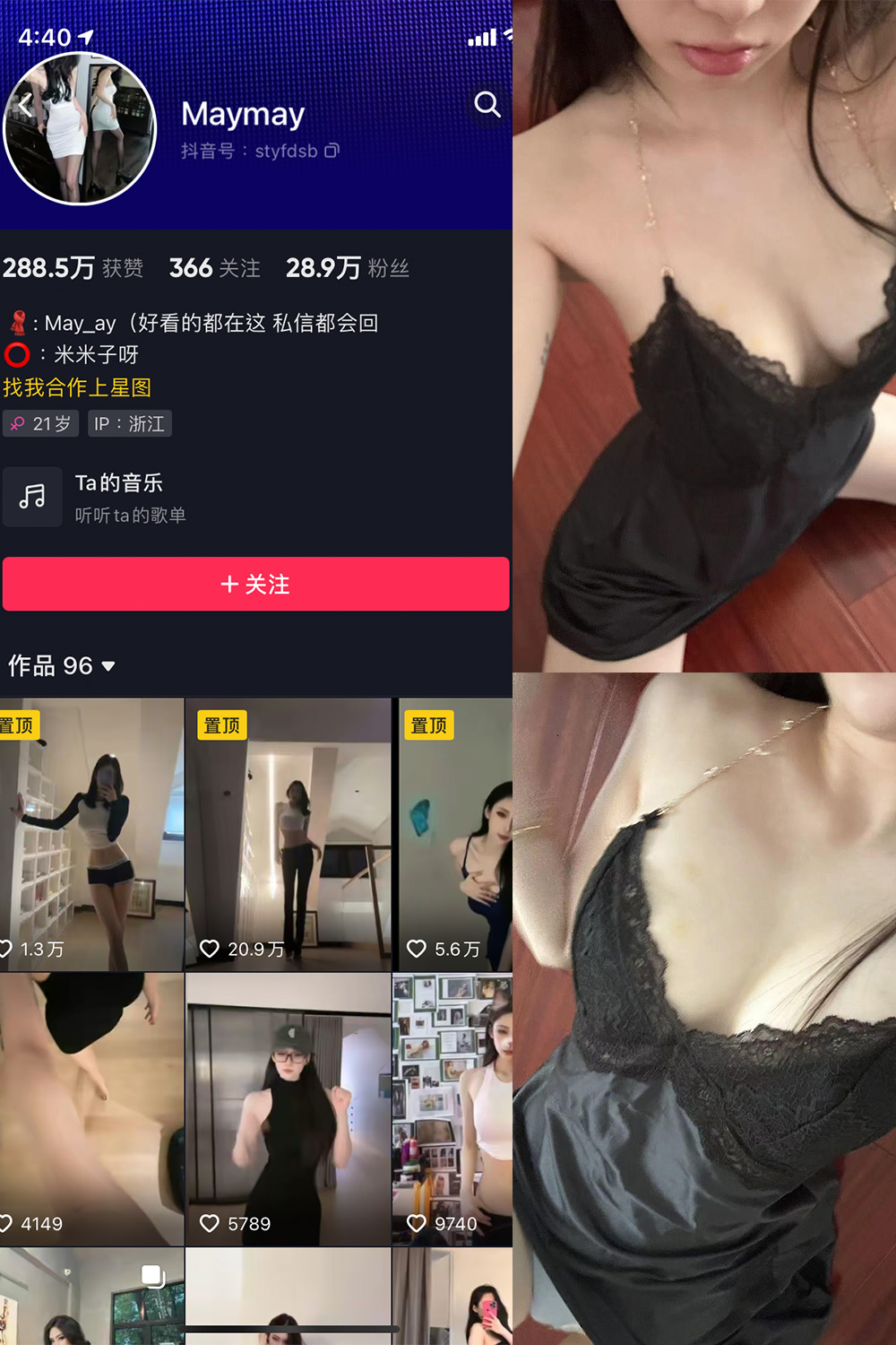 抖音 米米子呀 微密圈 NO.008期 更新至:2023.7.27