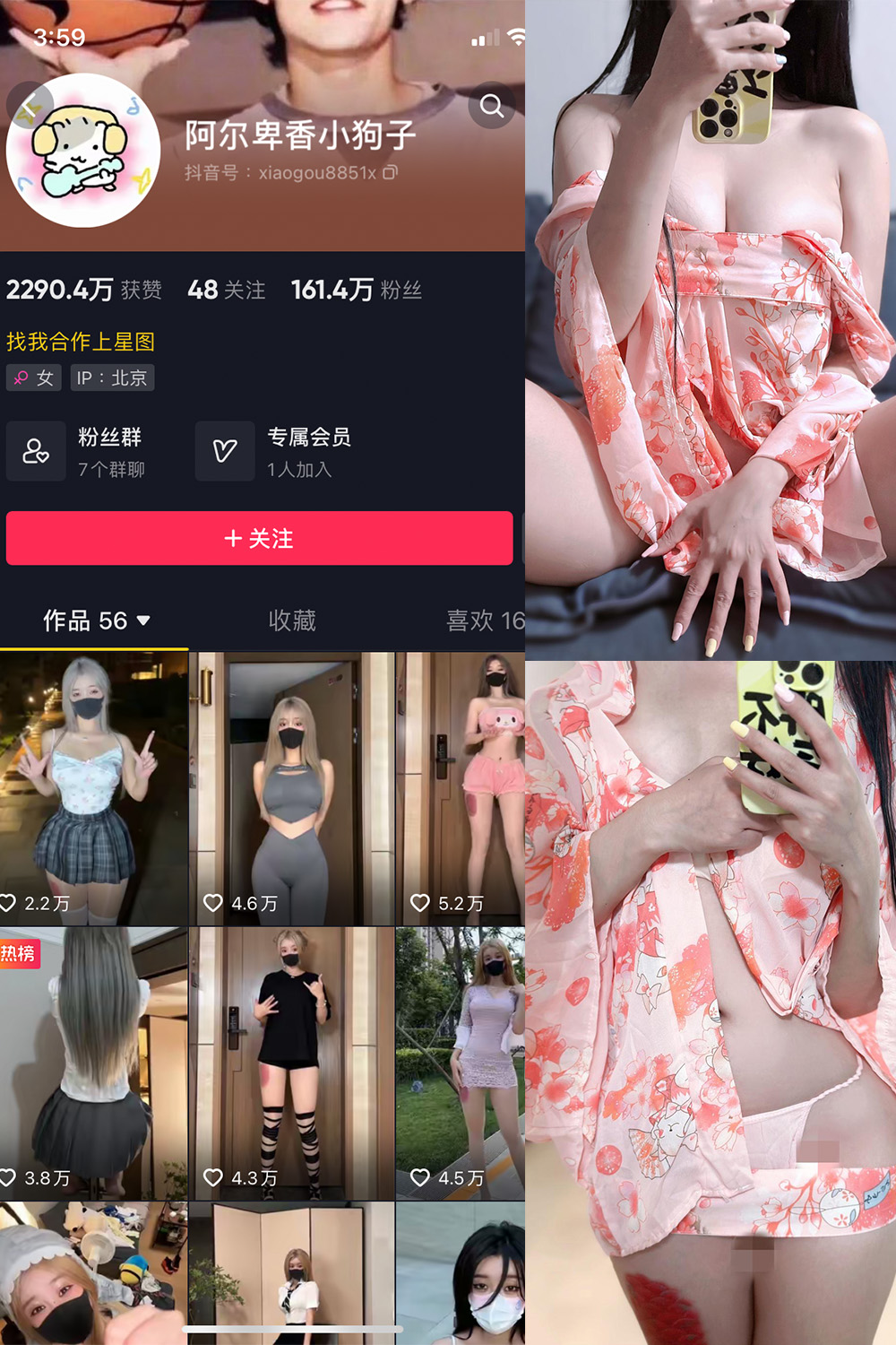 抖音 阿尔卑香小狗子 微密圈 NO.052期 更新至:2024.7.11