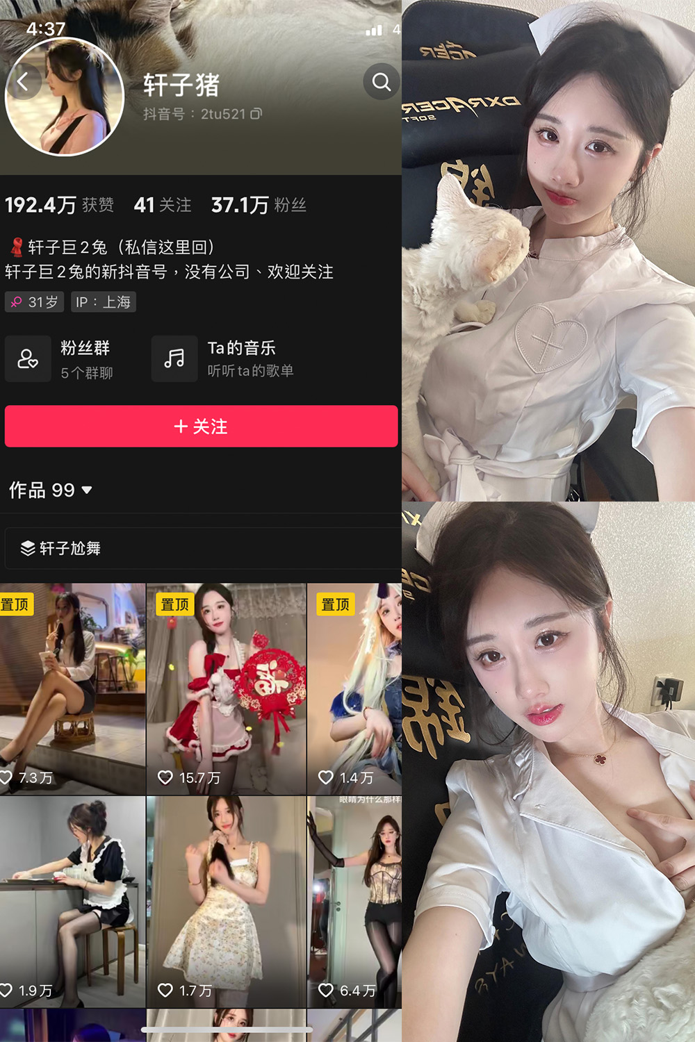 抖音 轩子巨二兔 微密圈 NO.023期 更新至:2024.3.15