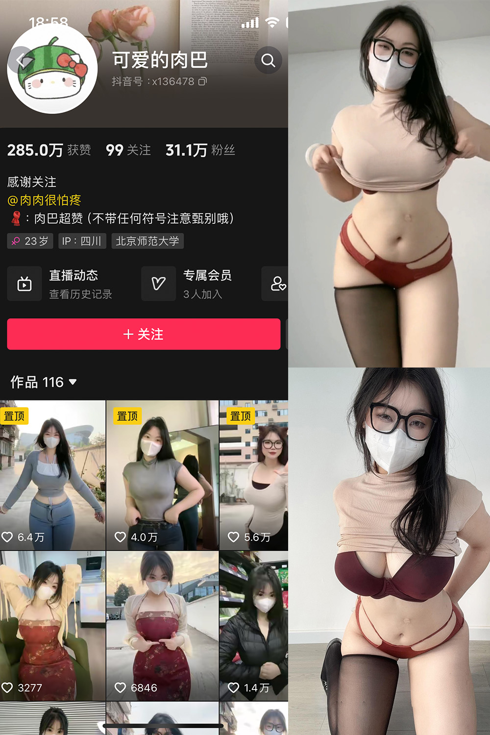 抖音 可爱的肉巴 微密圈 NO.009期 更新至:2024.11.7