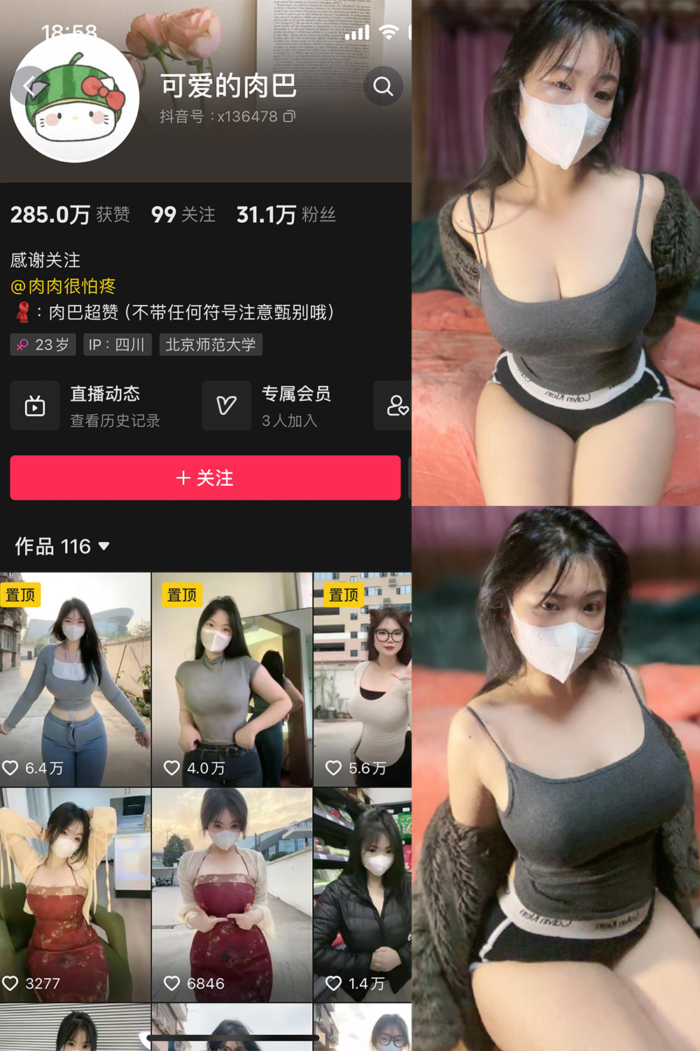 抖音 可爱的肉巴 微密圈 NO.011期 更新至:2024.2.19