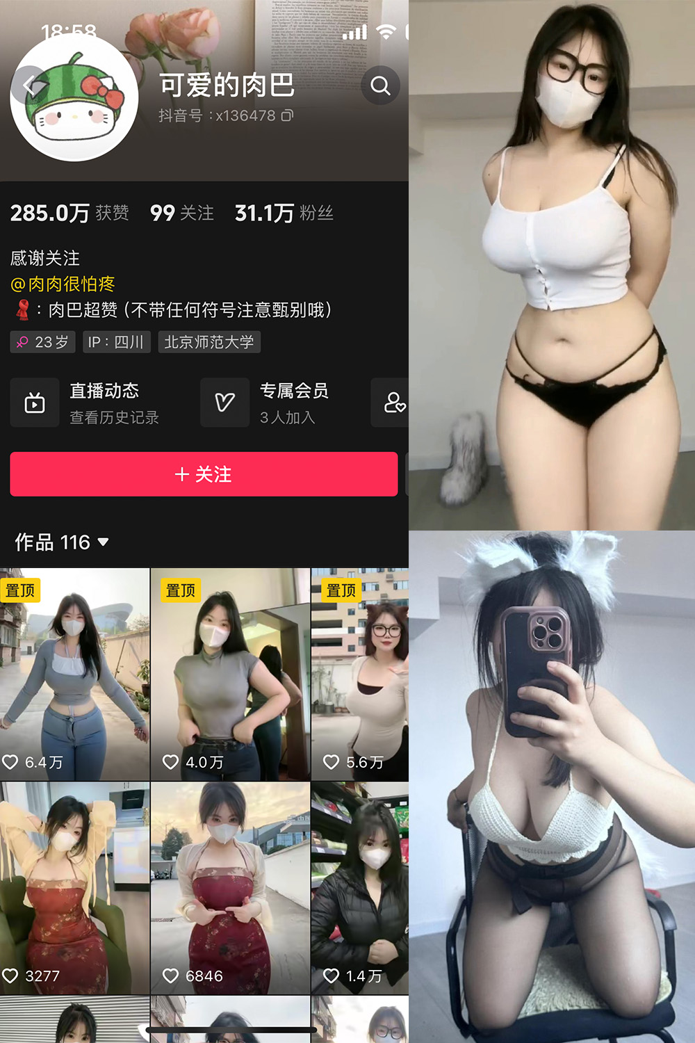 抖音 可爱的肉巴 微密圈 NO.014期 更新至:2024.3.7