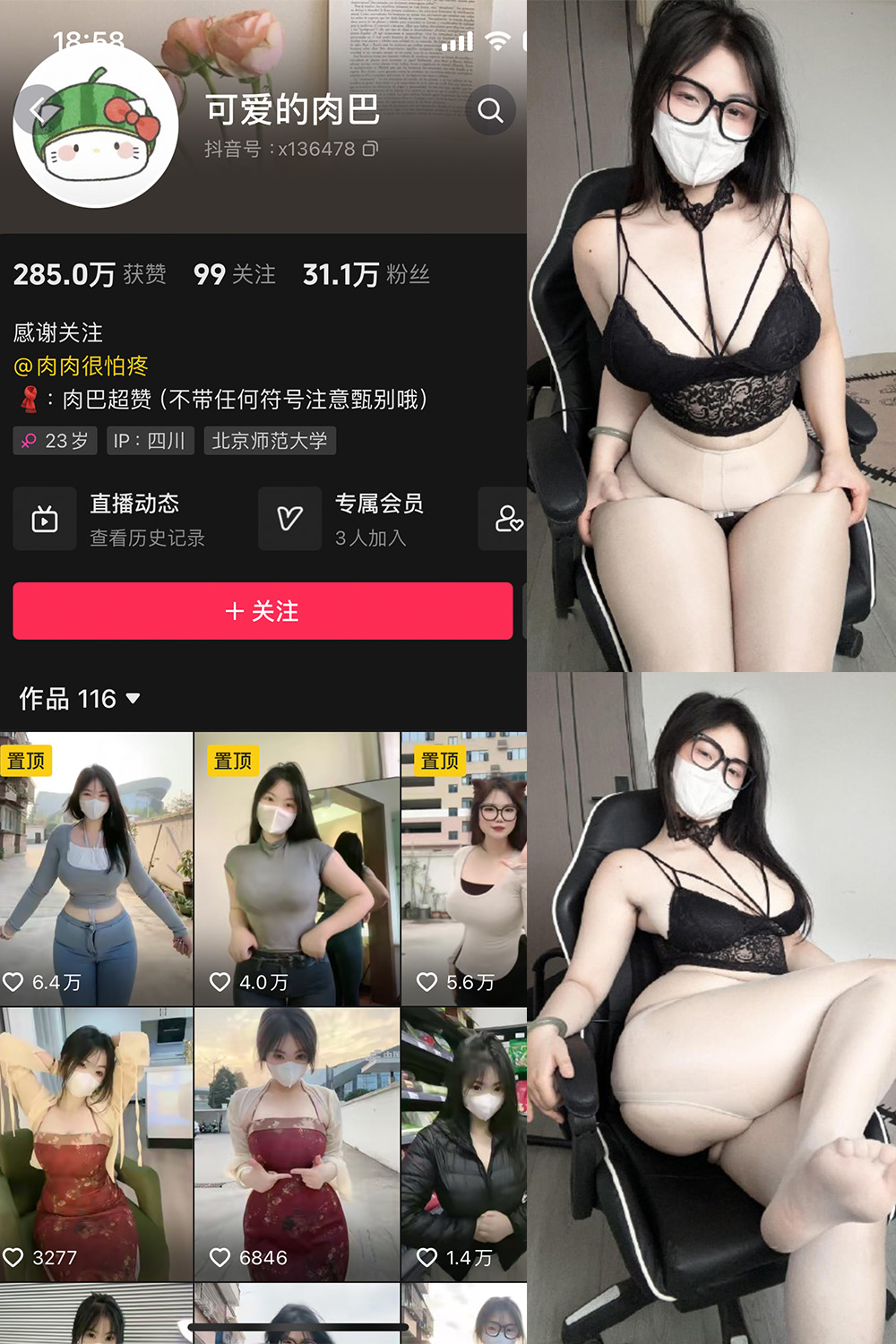 抖音 可爱的肉巴 微密圈 NO.022期 更新至:2024.4.25