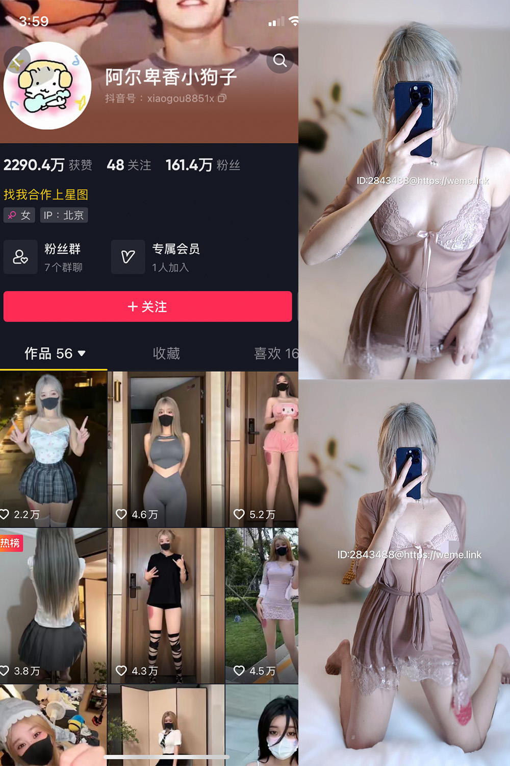抖音 阿尔卑香小狗子 微密圈 NO.007期 - 预览图 1
